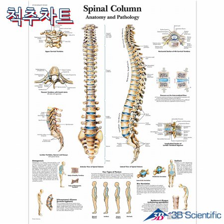3B 척추차트 VR1152 Spinal Column 척추질병 병원액자_액자추가