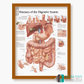 3B Scientific 소화기질병 인체해부차트 VR1431 소화계질환 병원액자_액자추가