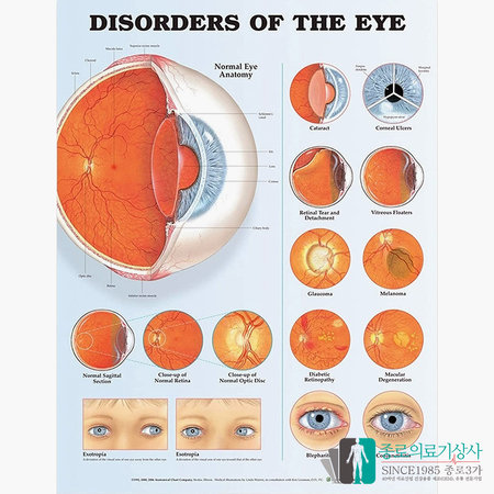 롯데하이마트 | 인체해부도 3D차트 병원액자 9695B 안과 안구질병 54X74cm 액자옵션_액자추가