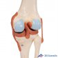 3B Scientific 인체모형 A82/1 고급형 슬관절모형 유연한 무릎관절과 인대