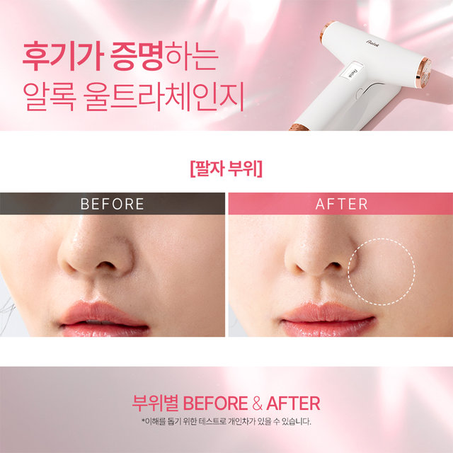 [신상품] 알록 울트라체인지 AUHR-3000