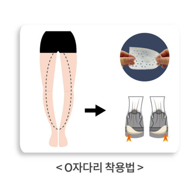 쿨핀 국내생산 오다리깔창 X자다리 오다리교정 탐나힐 뒤꿈치패드 2개 1세트